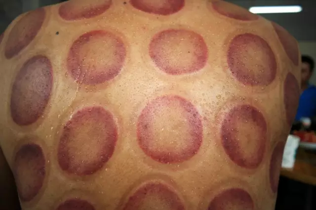 blob.png