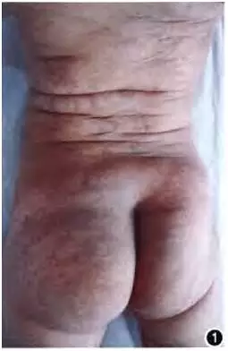 blob.png