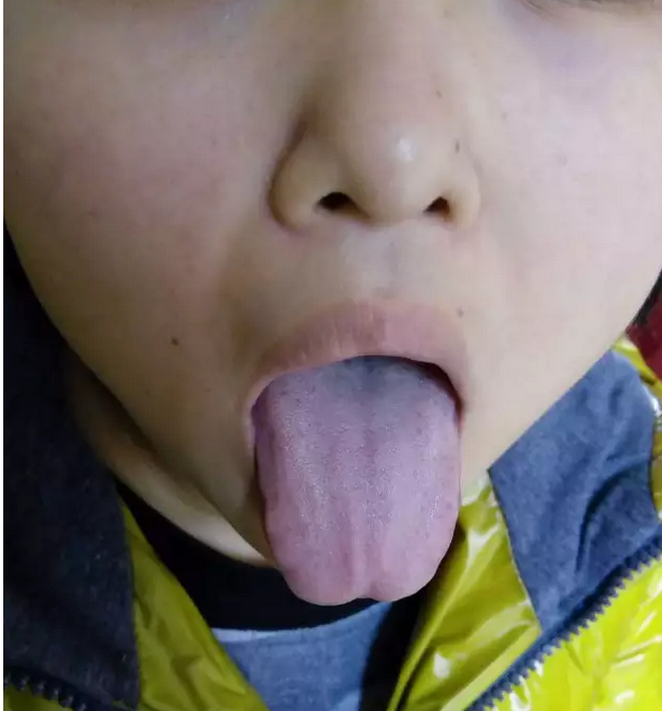 blob.png blob.png