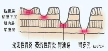 微信图片_20180126142825.jpg