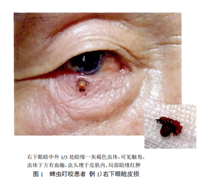 微信圖片_20200428142027.png